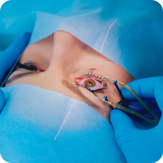 Procedimento de cirurgia refrativa