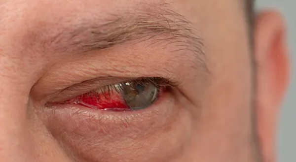 Exame oftalmológico para acompanhamento da retina